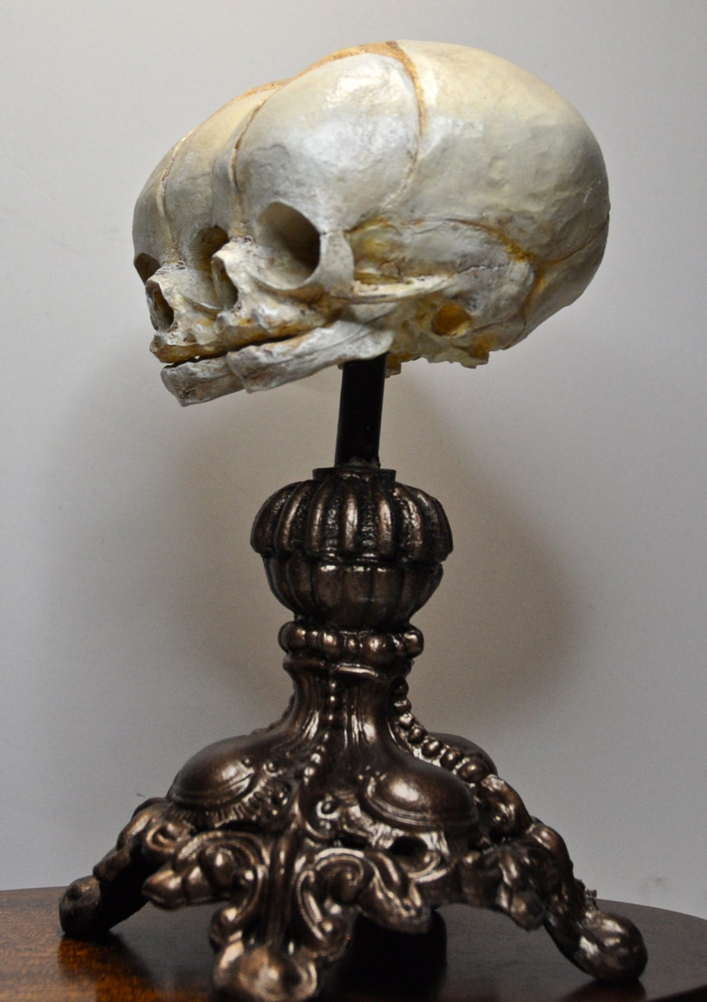 Conjoined Twins Fetal Skull Display