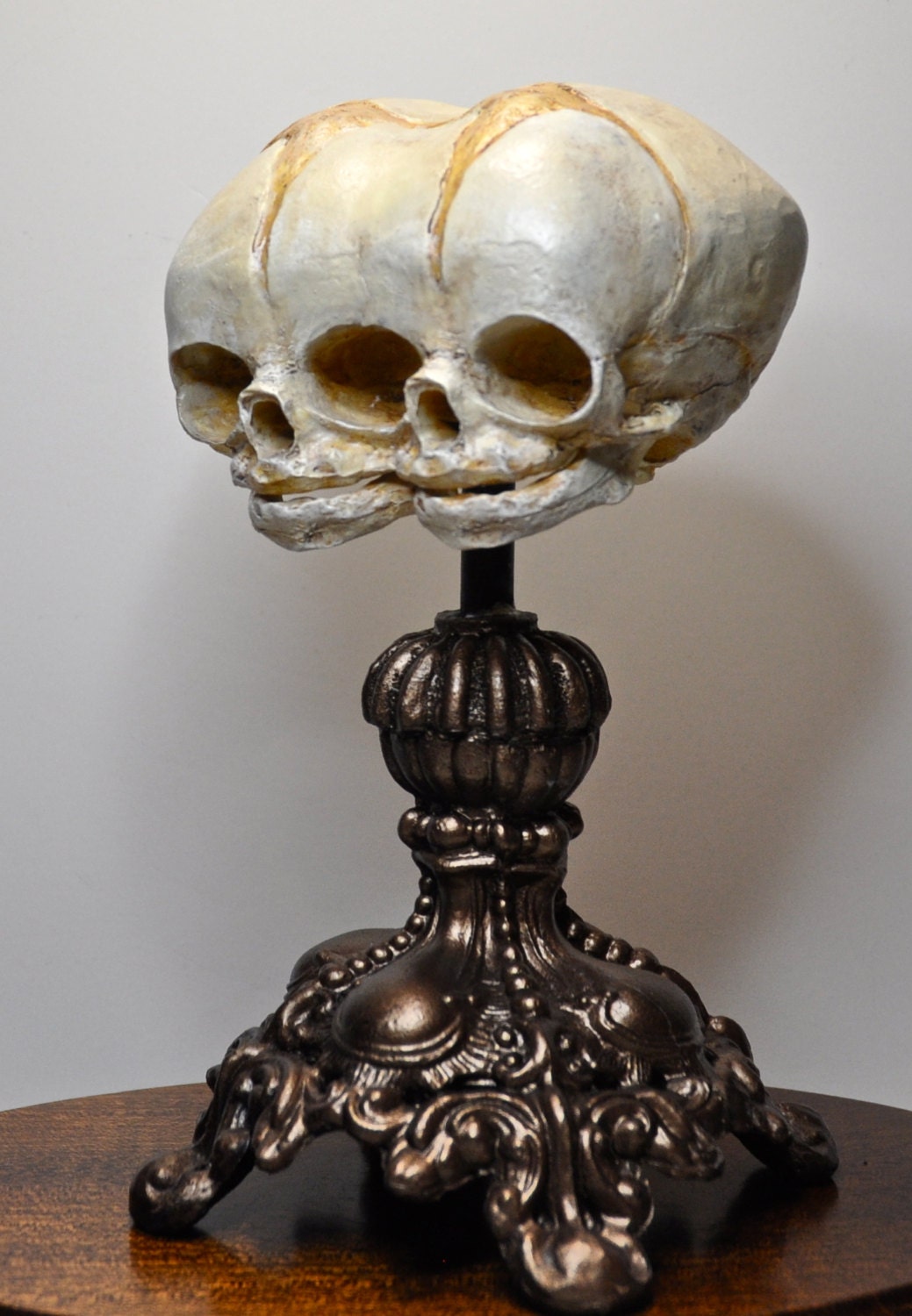 Conjoined Twins Fetal Skull Display