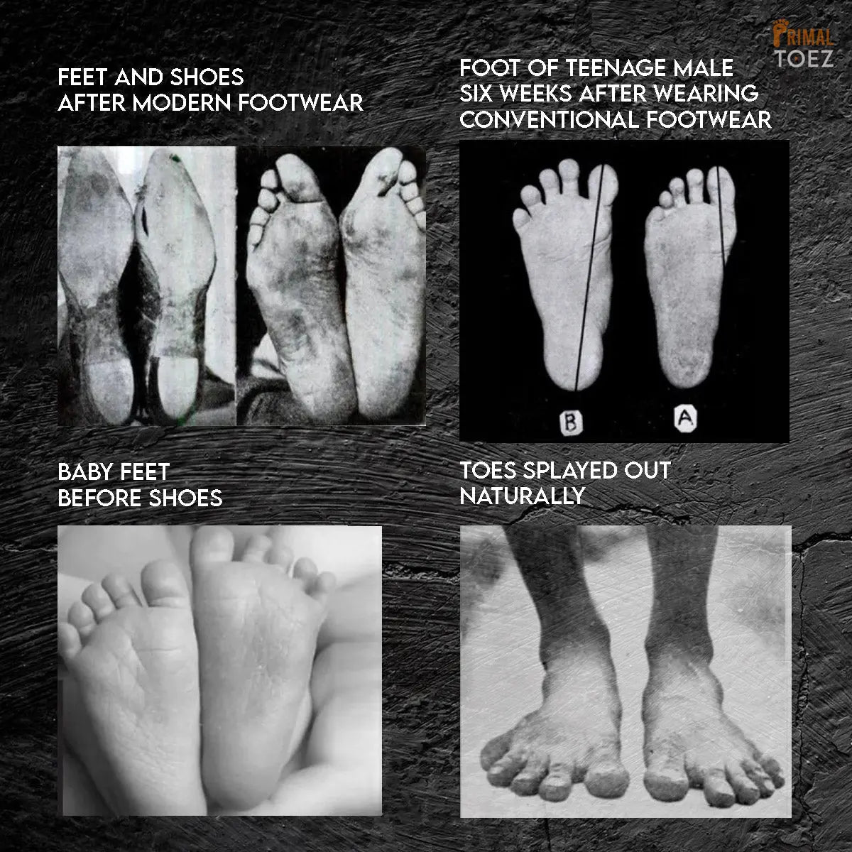 Primal Toez™ 'Deep Spacers' - Therapeutic Toe Spacers